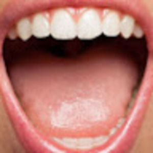 Meet your Posher, Emmett